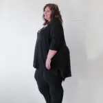 Angel Anderson living with lipedema before life changing lipedema reduction surgery.