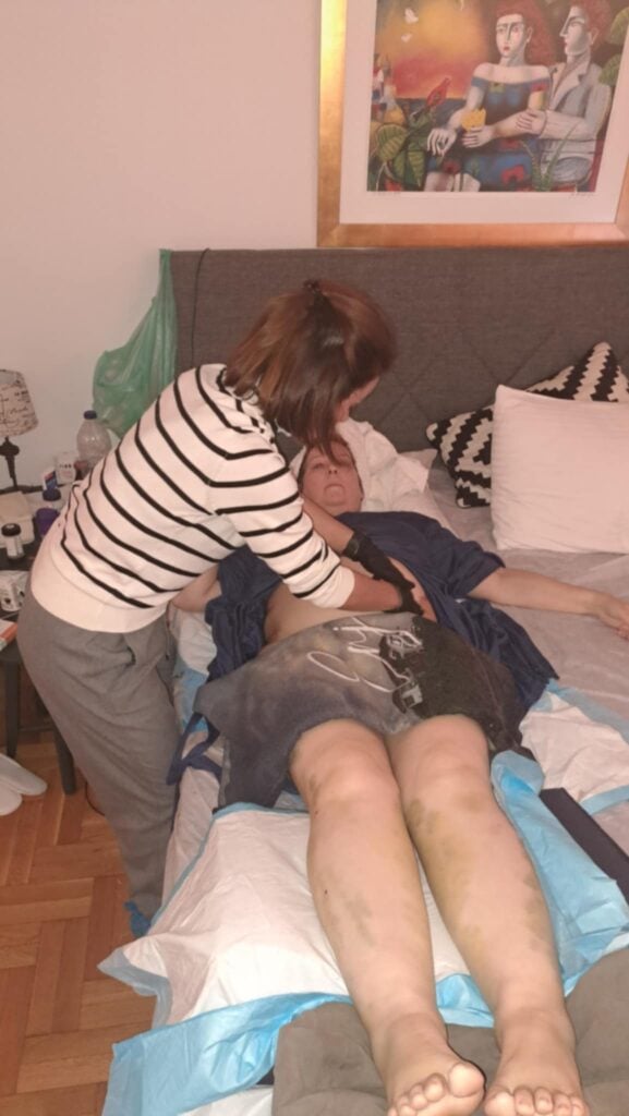 Holly's Surgery Journey Day 6 & 7 2 5a1c42c3 b83b 447e 90d2 11873ebdd1ee