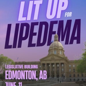 Lipedema Awareness Month 6 AB Edmonton Legislative Building