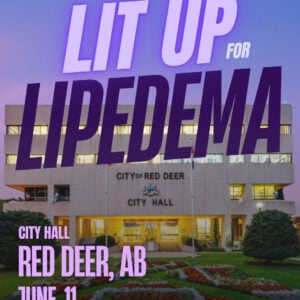Lipedema Awareness Month 9 AB Red Deer City Hall