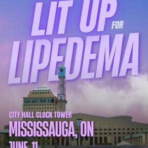 Lipedema Awareness Month 62 ON MISSISSAUGA City Hall Clock Tower