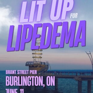 Lipedema Awareness Month 51 ON Burlington Brant st Pier