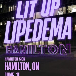 Lipedema Awareness Month 82 ON Hamilton Hamilton Sign