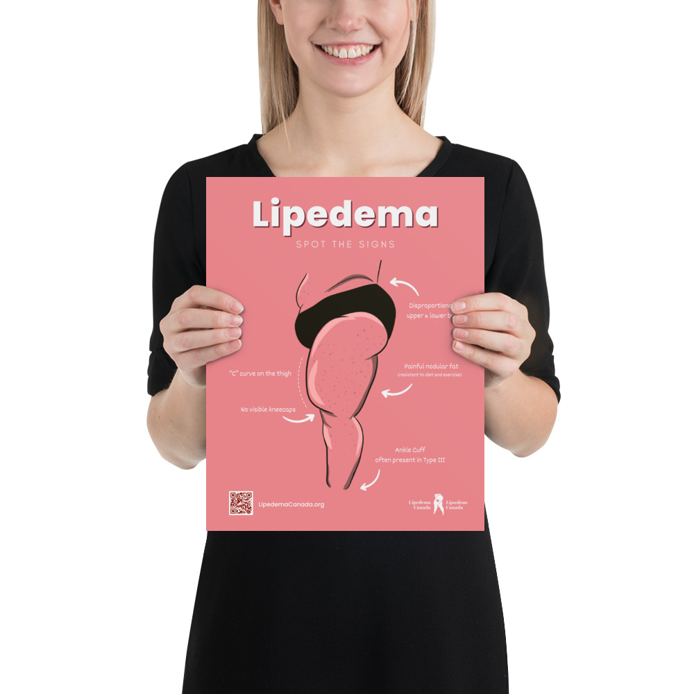 Lipedema: Spot the Signs Poster 11x14