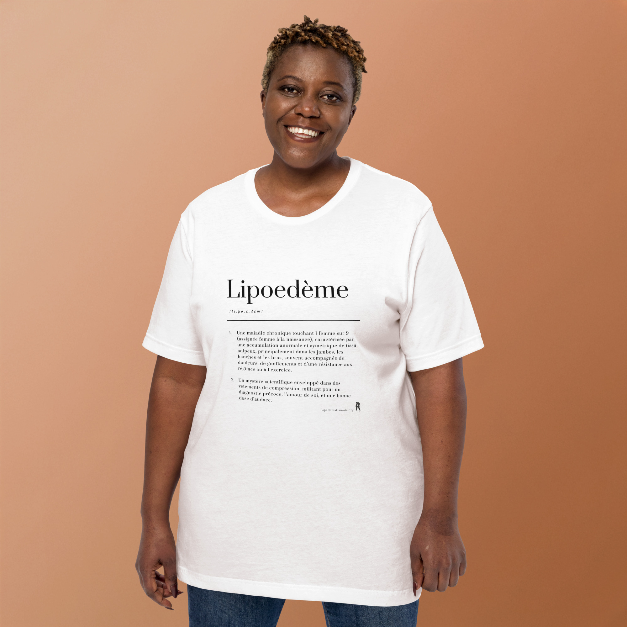 « Lipedema defined »